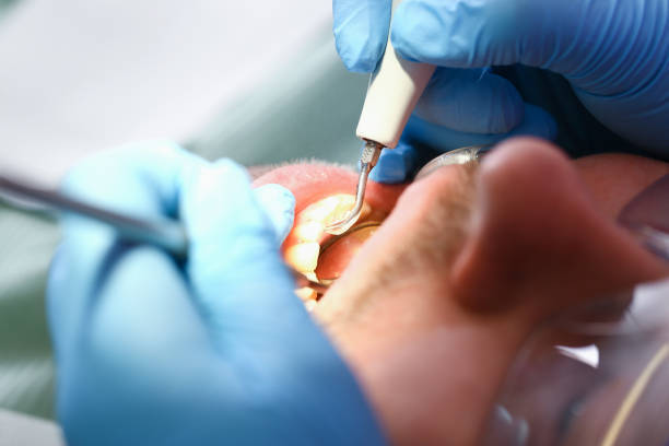 Best Pediatric Emergency Dentist in Charlotte, MI