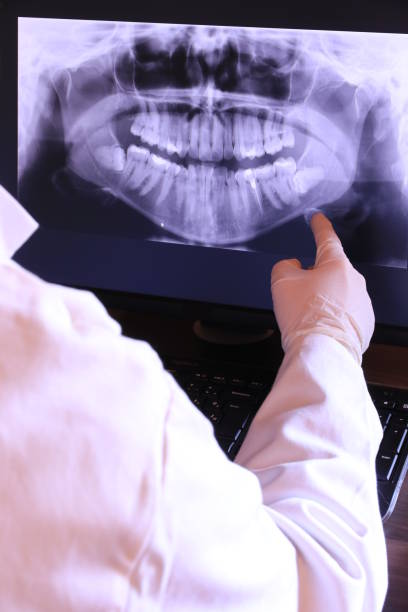 Best Emergency Dentist for Knocked-Out Tooth in Charlotte, MI